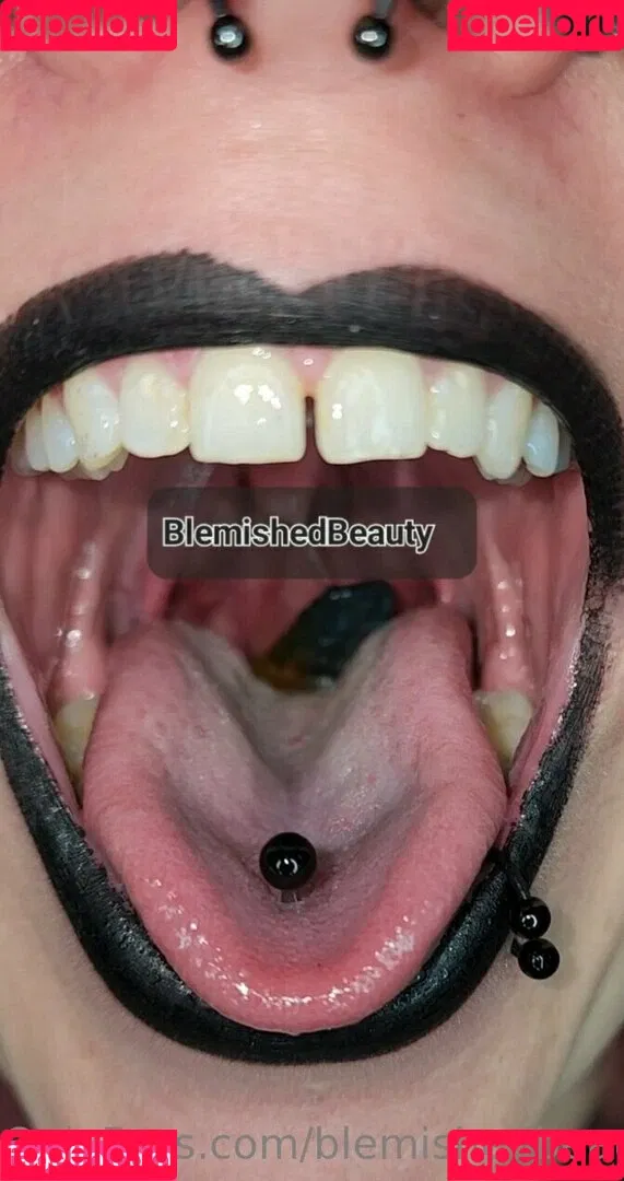 blemishedbeauty Onlyfans Photo Gallery 