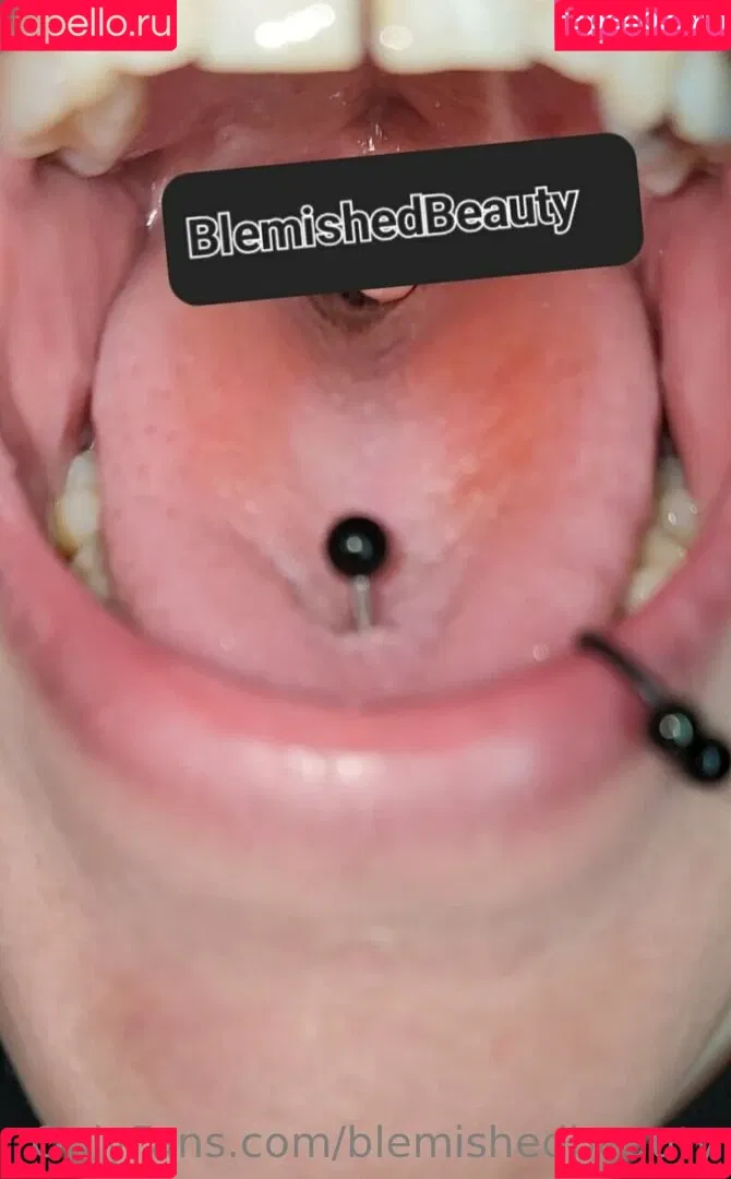 blemishedbeauty Onlyfans Photo Gallery 