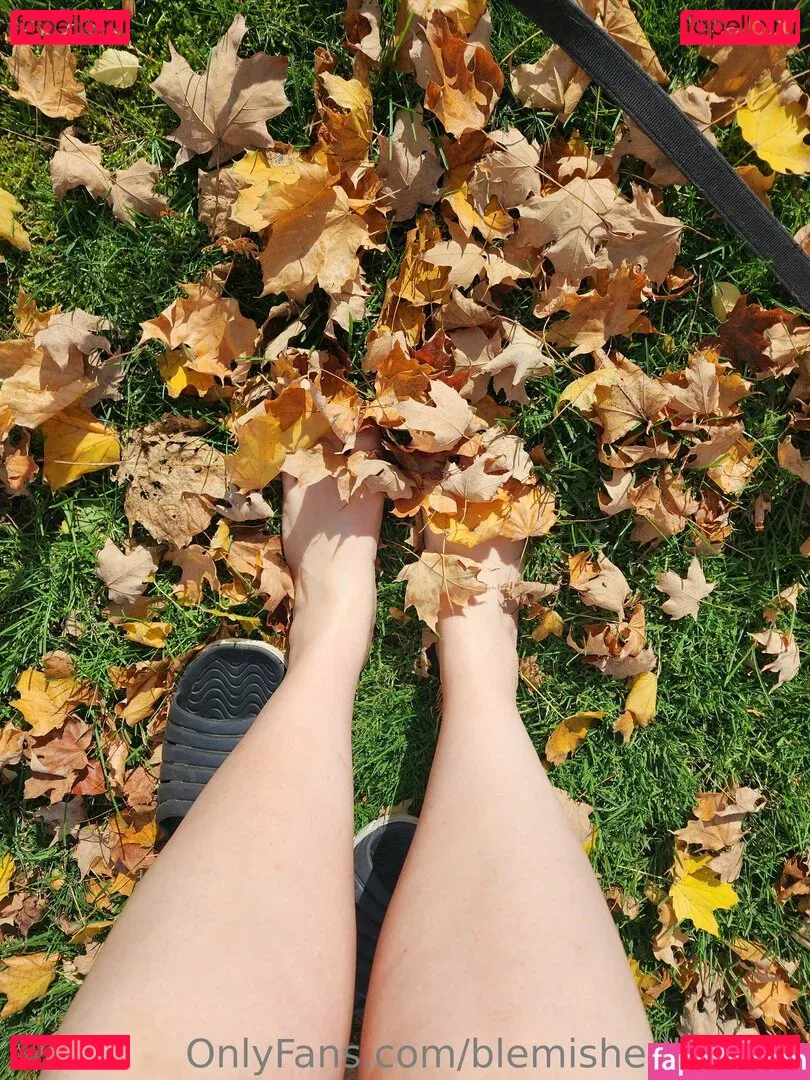 blemishedbeauty Onlyfans Photo Gallery 