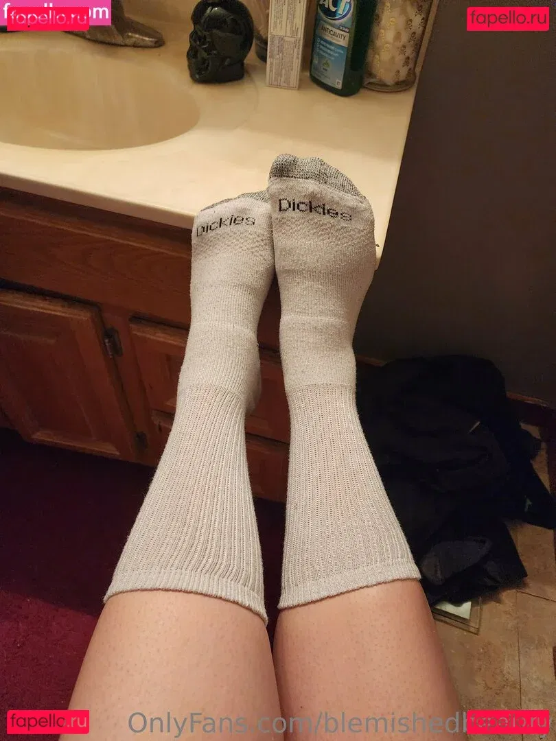 blemishedbeauty Onlyfans Photo Gallery 