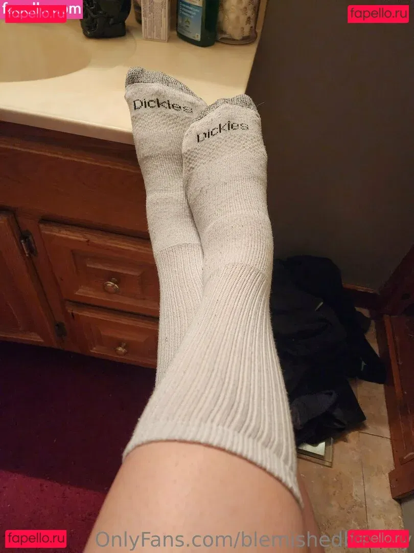 blemishedbeauty Onlyfans Photo Gallery 