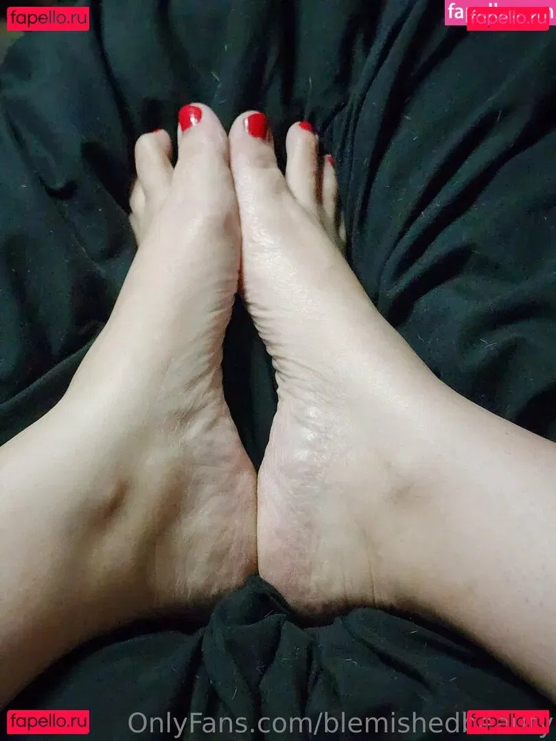 blemishedbeauty Onlyfans Photo Gallery 