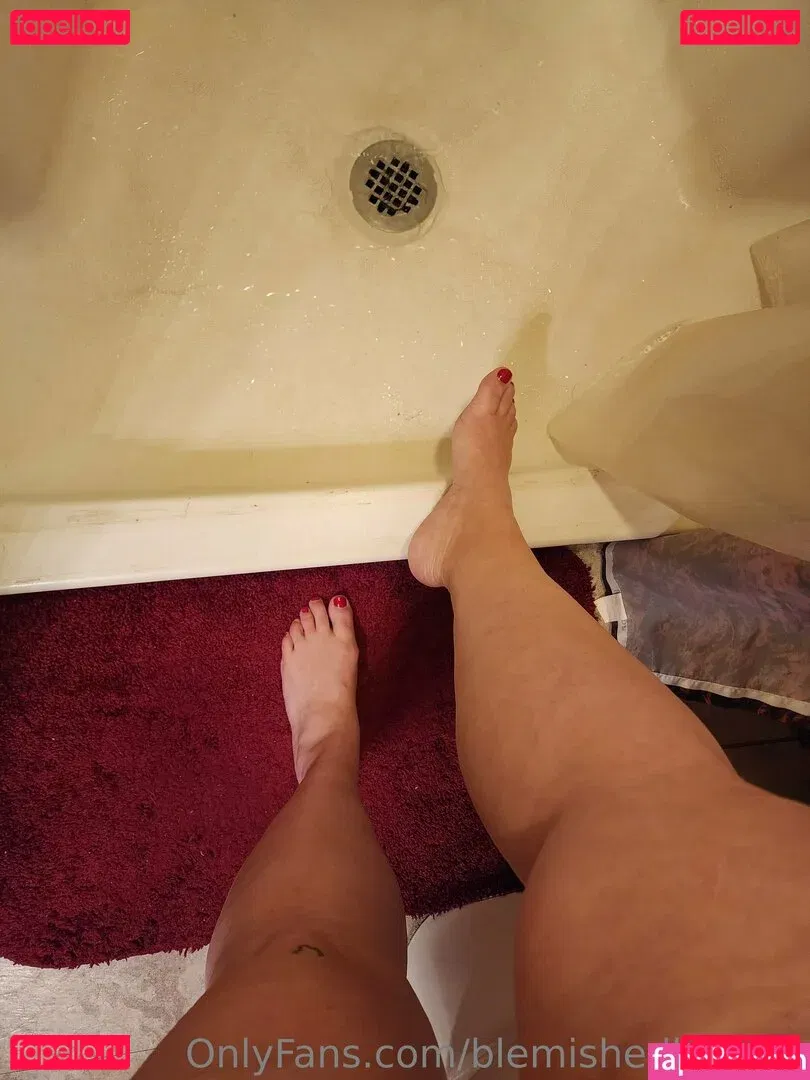 blemishedbeauty Onlyfans Photo Gallery 