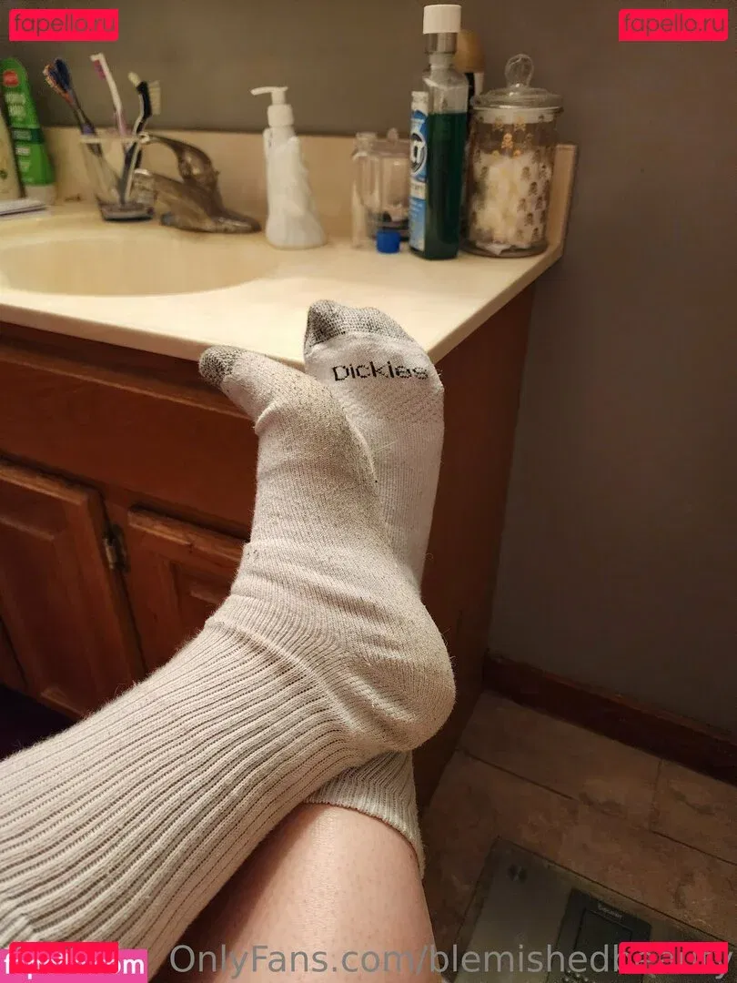 blemishedbeauty Onlyfans Photo Gallery 