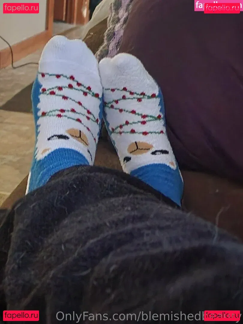 blemishedbeauty Onlyfans Photo Gallery 