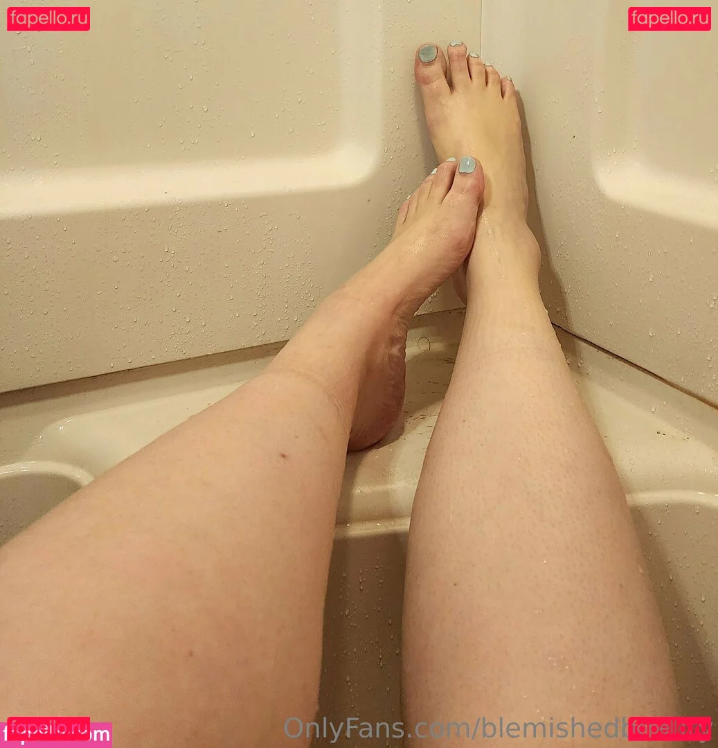 blemishedbeauty Onlyfans Photo Gallery 