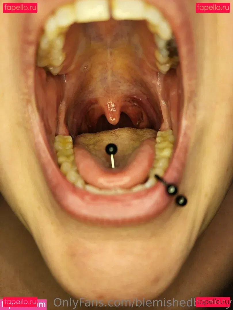 blemishedbeauty Onlyfans Photo Gallery 