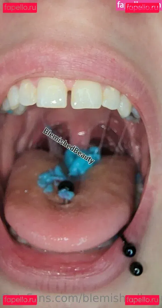 blemishedbeauty Onlyfans Photo Gallery 