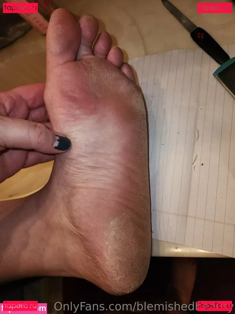 blemishedbeauty Onlyfans Photo Gallery 