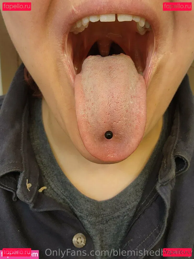 blemishedbeauty Onlyfans Photo Gallery 