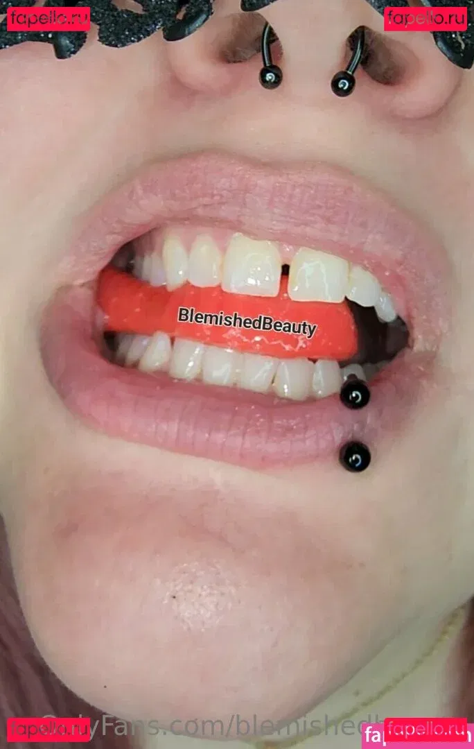 blemishedbeauty Onlyfans Photo Gallery 