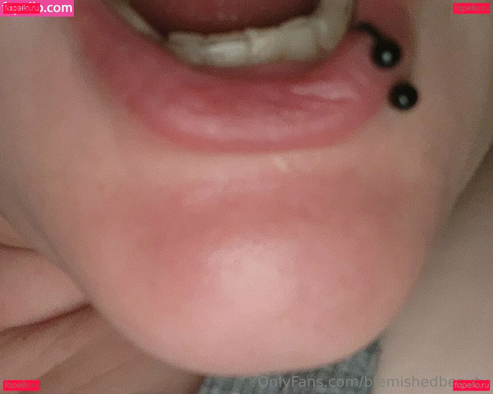 blemishedbeauty Onlyfans Photo Gallery 