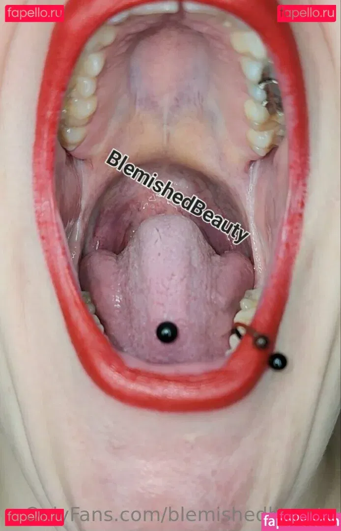 blemishedbeauty Onlyfans Photo Gallery 