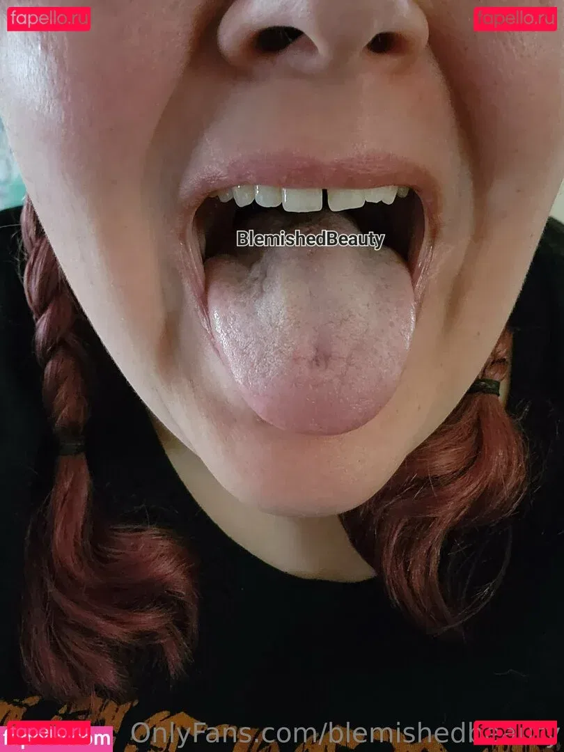 blemishedbeauty Onlyfans Photo Gallery 