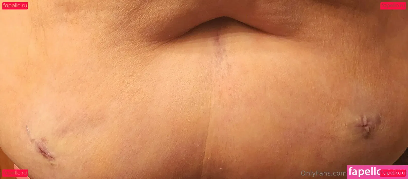 blemishedbeauty Onlyfans Photo Gallery 