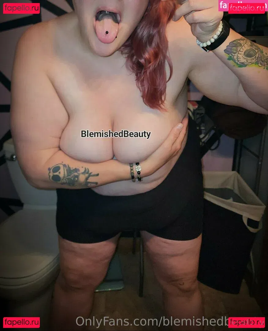 blemishedbeauty Onlyfans Photo Gallery 