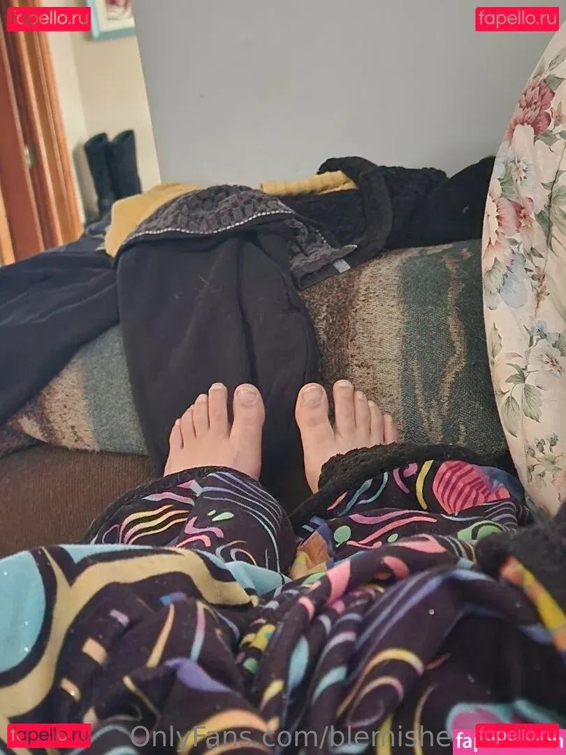 blemishedbeauty Onlyfans Photo Gallery 