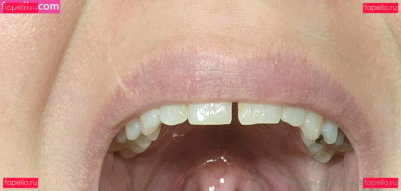 blemishedbeauty Onlyfans Photo Gallery 