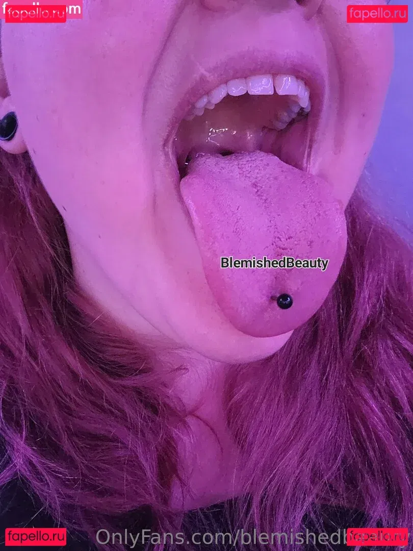 blemishedbeauty Onlyfans Photo Gallery 