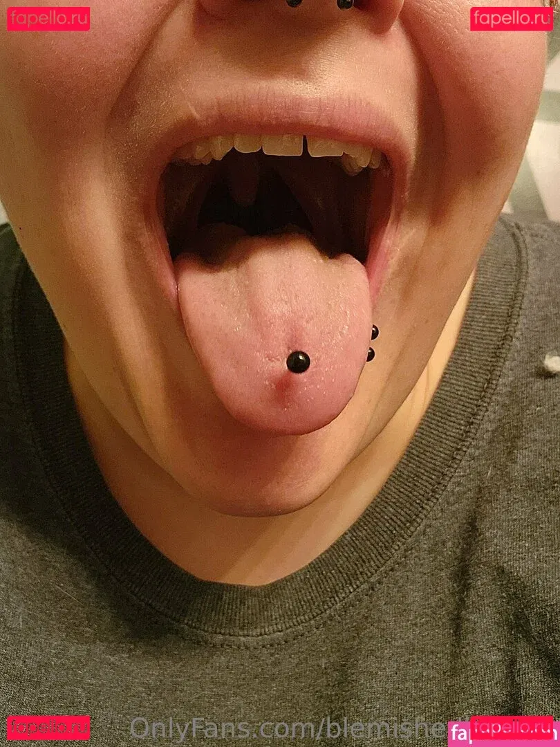 blemishedbeauty Onlyfans Photo Gallery 