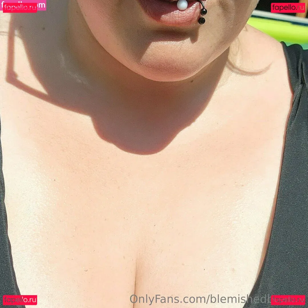 blemishedbeauty Onlyfans Photo Gallery 