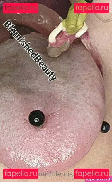 blemishedbeauty Onlyfans Photo Gallery 