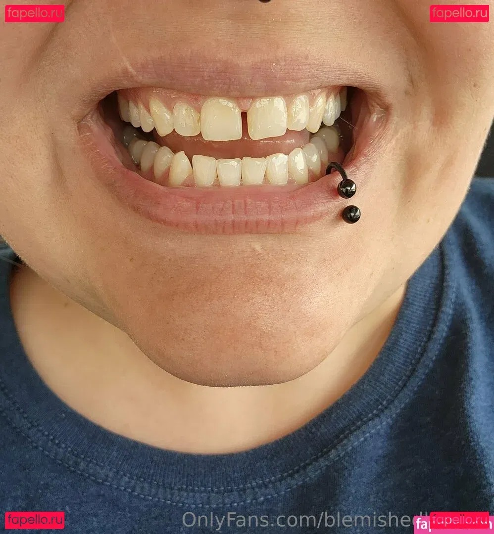 blemishedbeauty Onlyfans Photo Gallery 