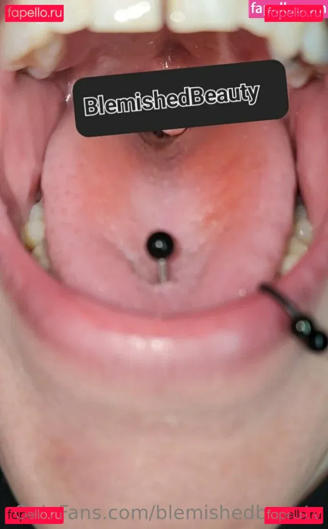 blemishedbeauty Onlyfans Photo Gallery 