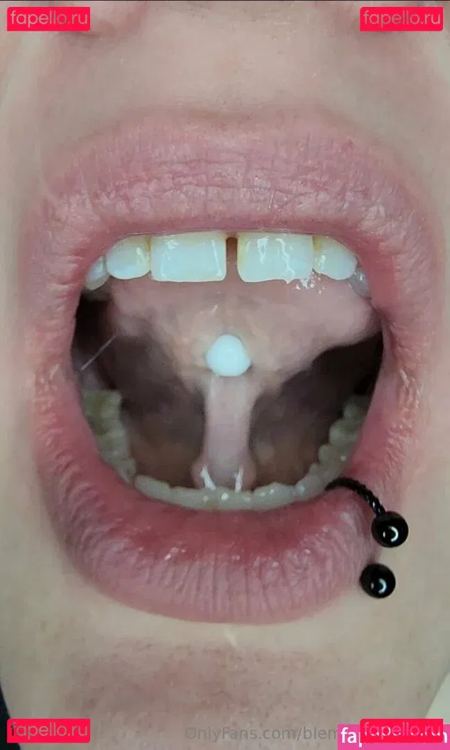 blemishedbeauty Onlyfans Photo Gallery 