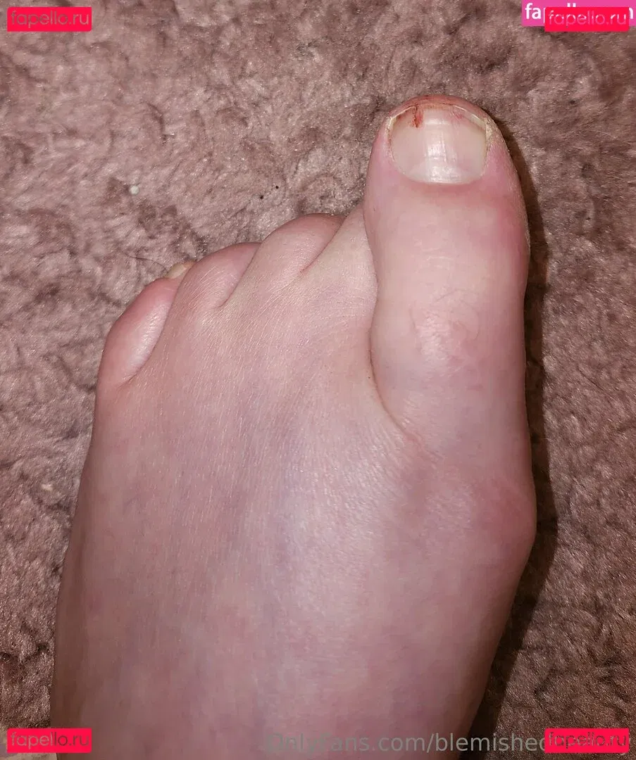 blemishedbeauty Onlyfans Photo Gallery 