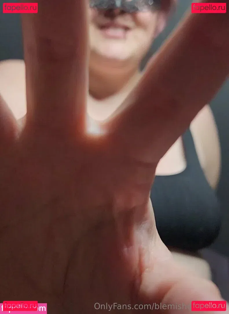 blemishedbeauty Onlyfans Photo Gallery 