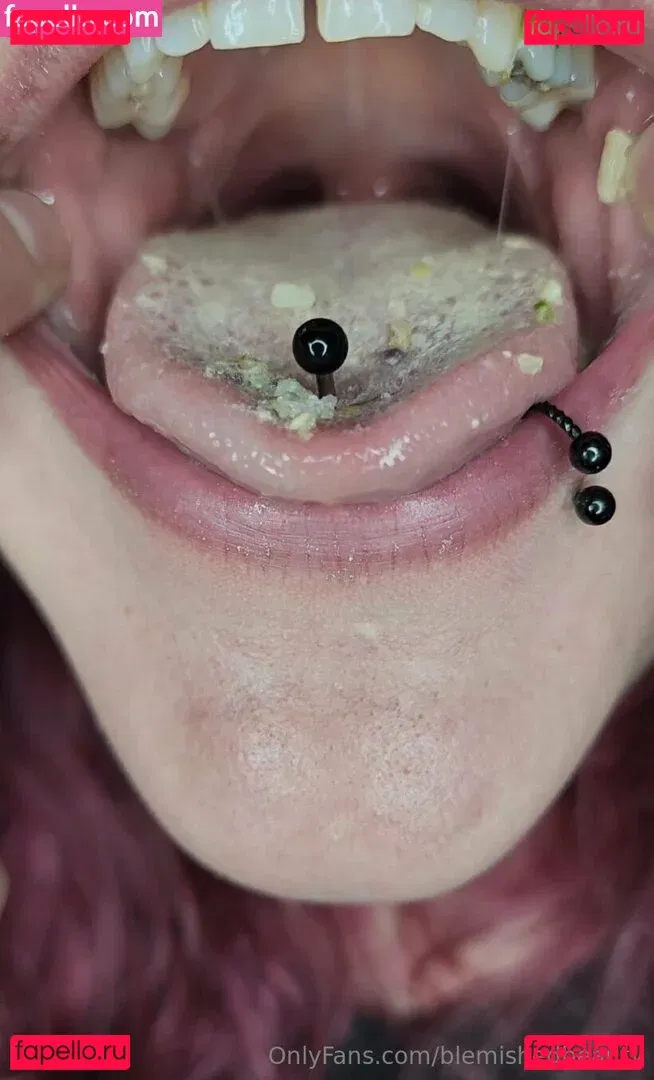 blemishedbeauty Onlyfans Photo Gallery 