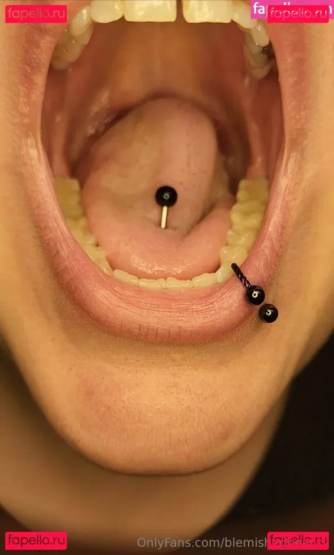 blemishedbeauty Onlyfans Photo Gallery 