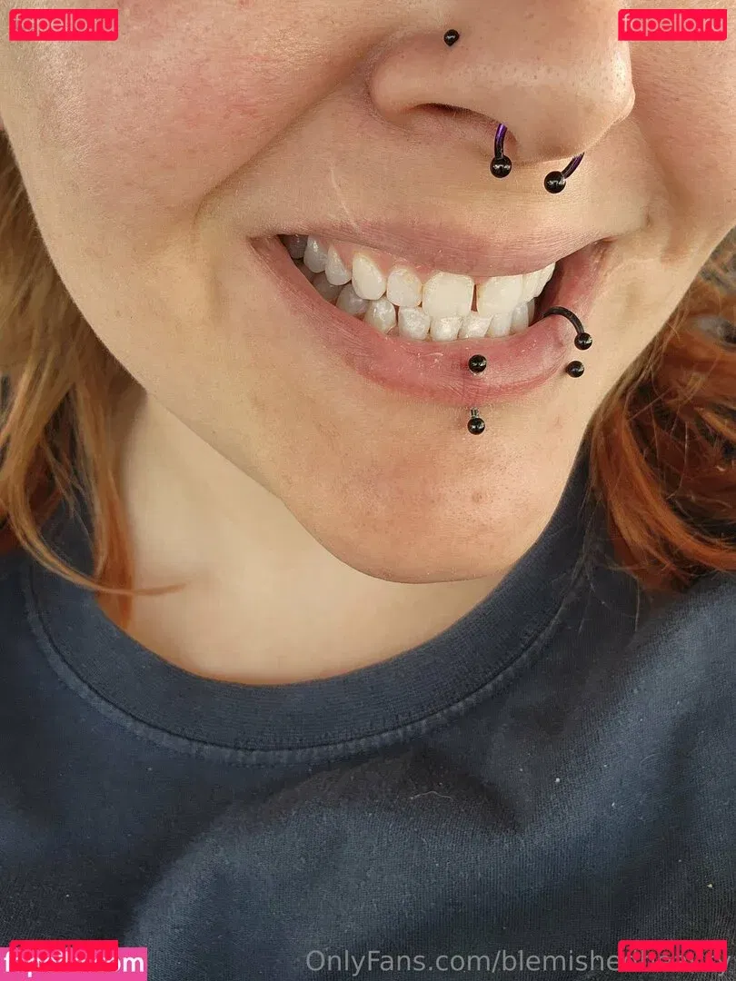 blemishedbeauty Onlyfans Photo Gallery 