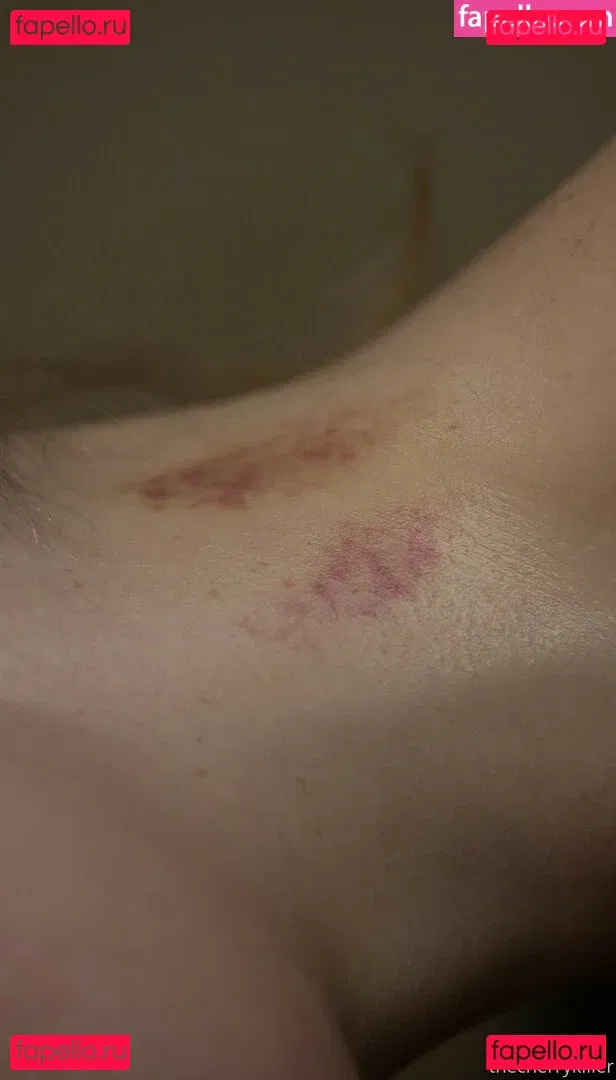 thestrawberrybutcher Onlyfans Photo Gallery 