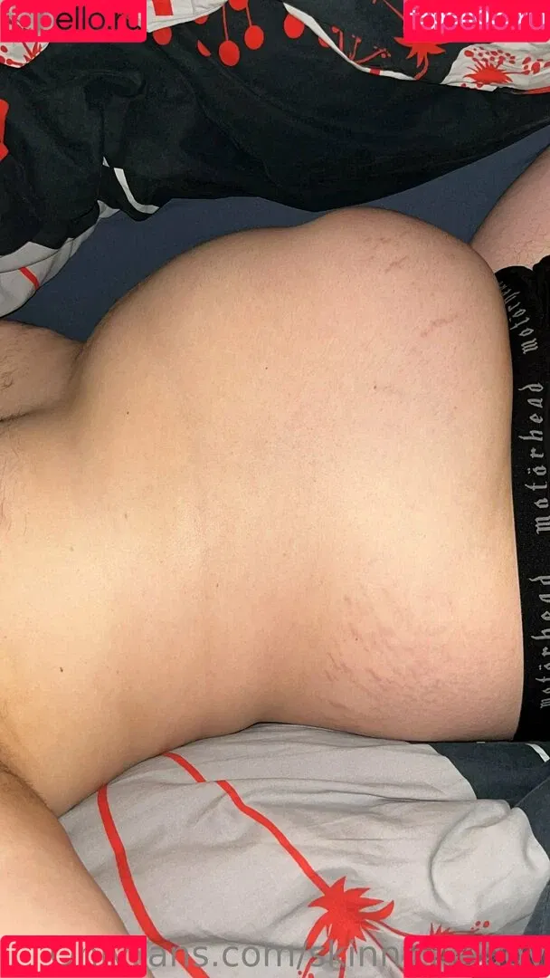 skinny.twiggy Onlyfans Photo Gallery 