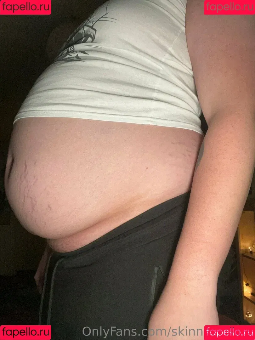 skinny.twiggy Onlyfans Photo Gallery 