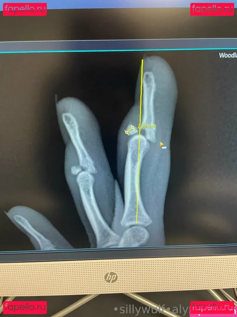 tinykittie Onlyfans Photo Gallery 