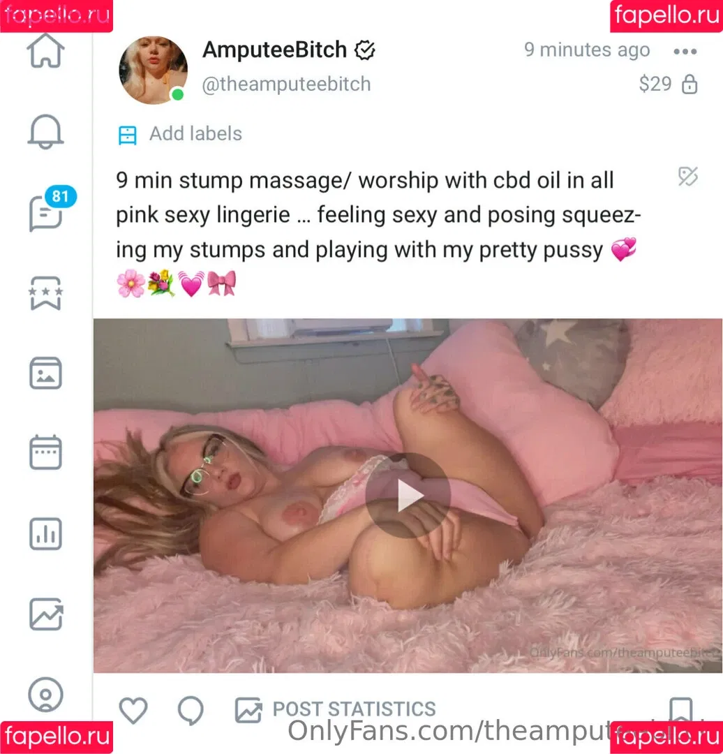 theamputeebitch Onlyfans Photo Gallery 