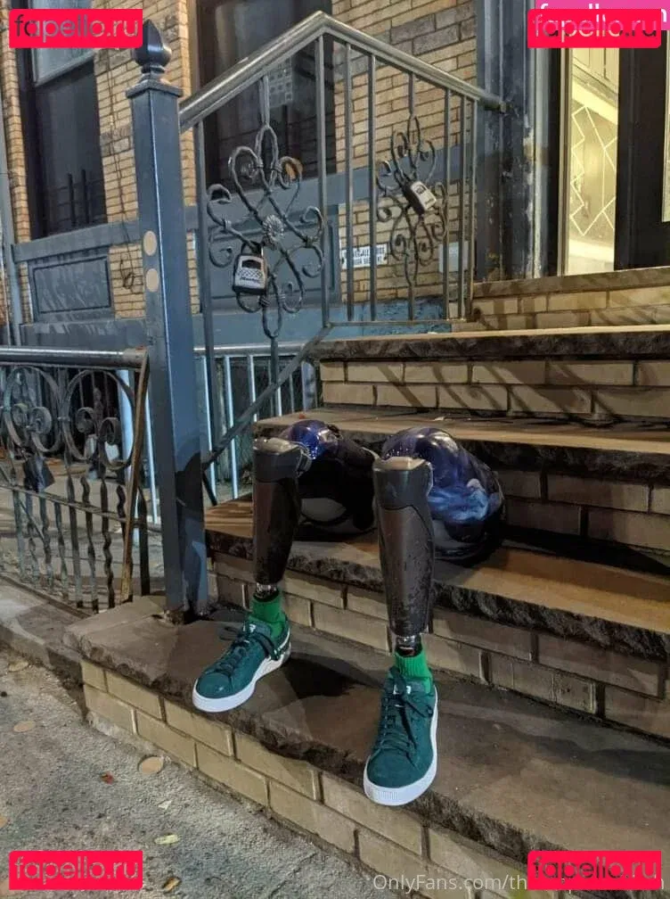 theamputeebitch Onlyfans Photo Gallery 