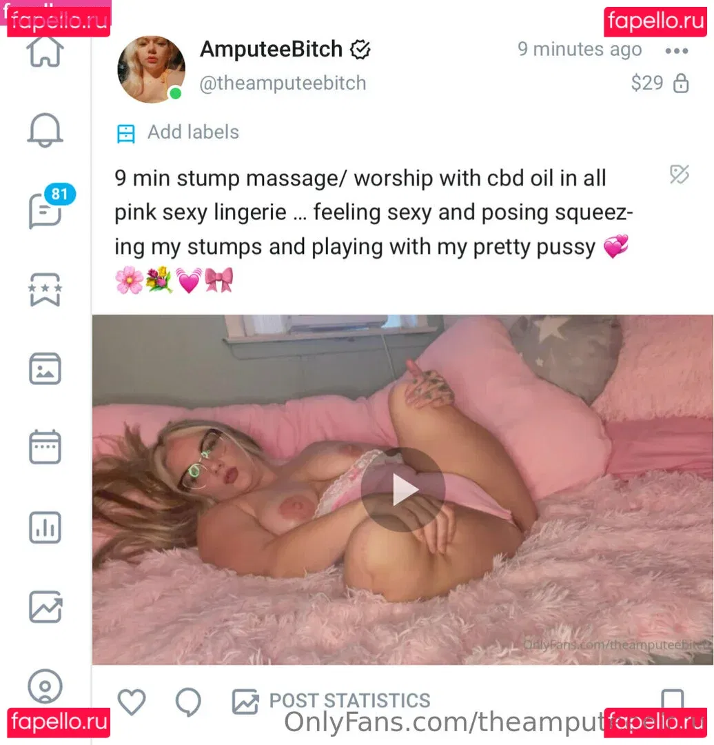 theamputeebitch Onlyfans Photo Gallery 