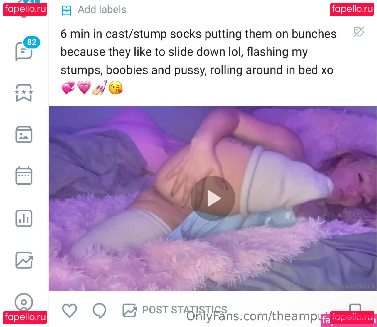 theamputeebitch Onlyfans Photo Gallery 