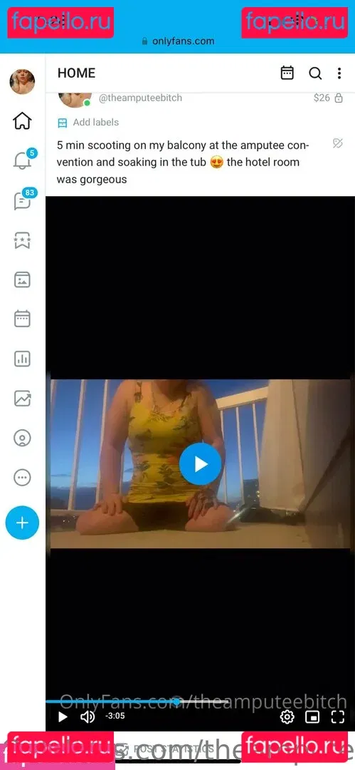 theamputeebitch Onlyfans Photo Gallery 