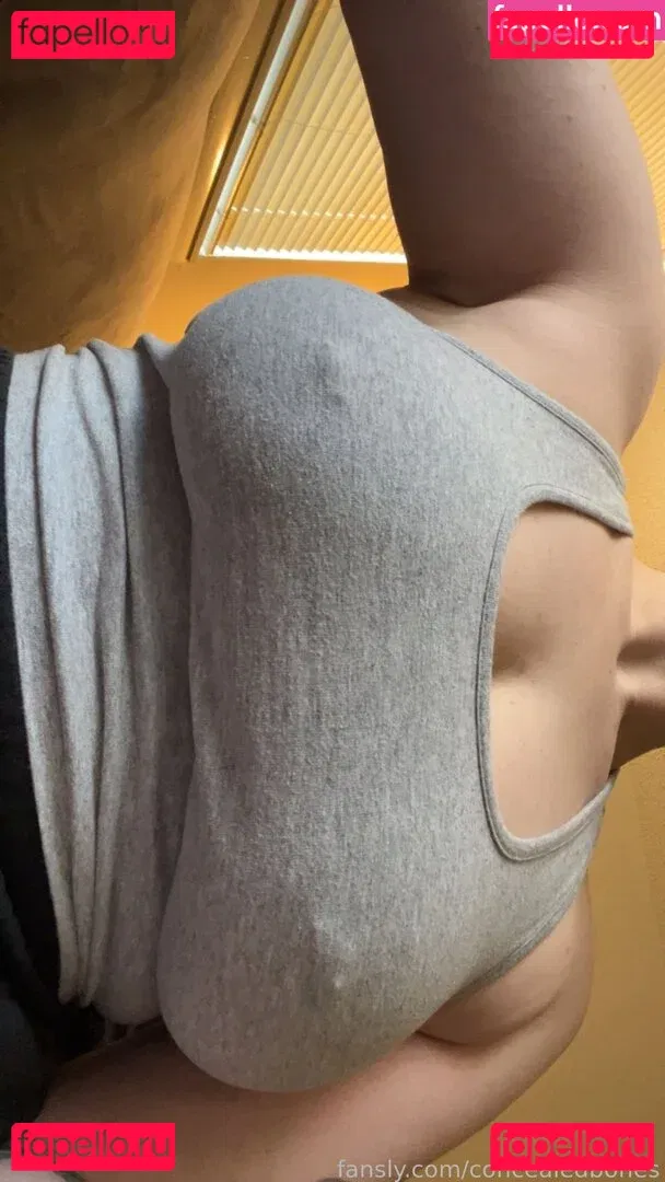 ConcealedBones Onlyfans Photo Gallery 