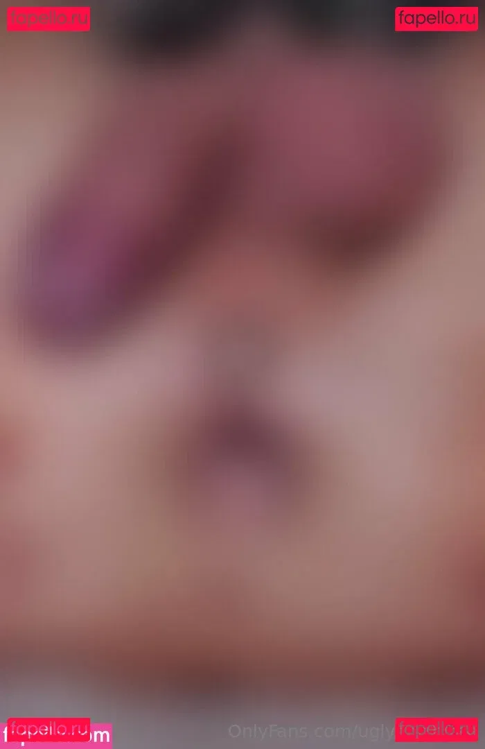 uglynorthfree Onlyfans Photo Gallery 