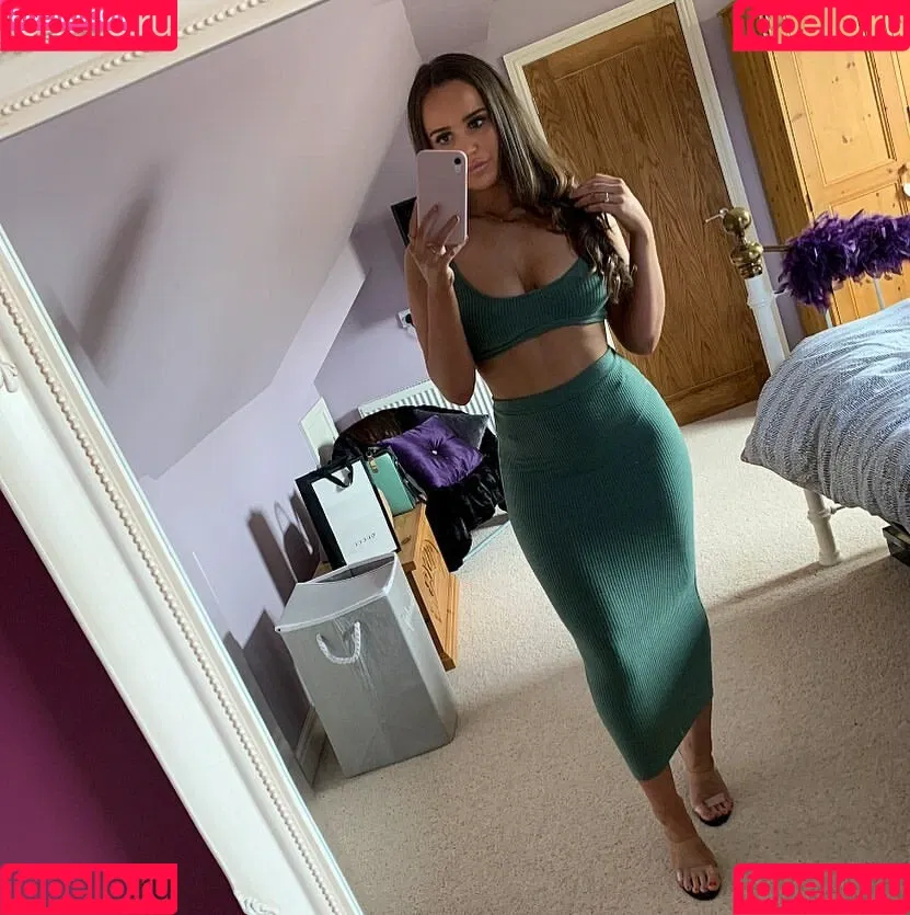 Aimee Stobbart Onlyfans Photo Gallery 