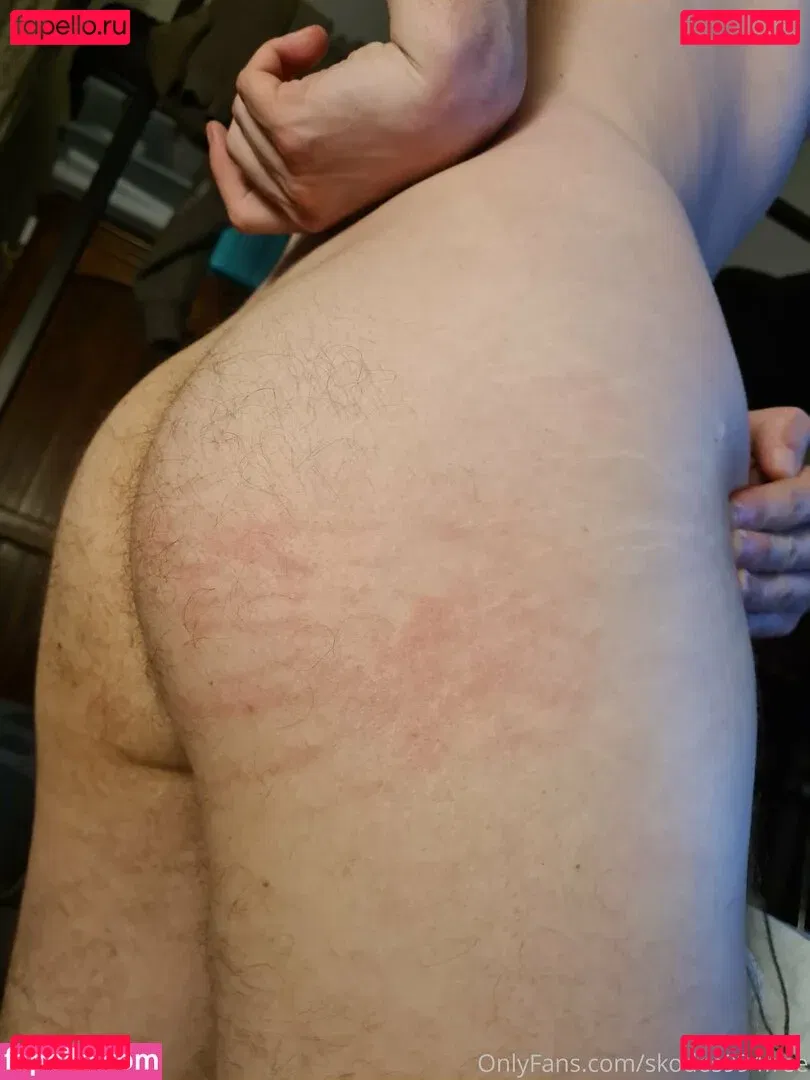 skodes994free Onlyfans Photo Gallery 