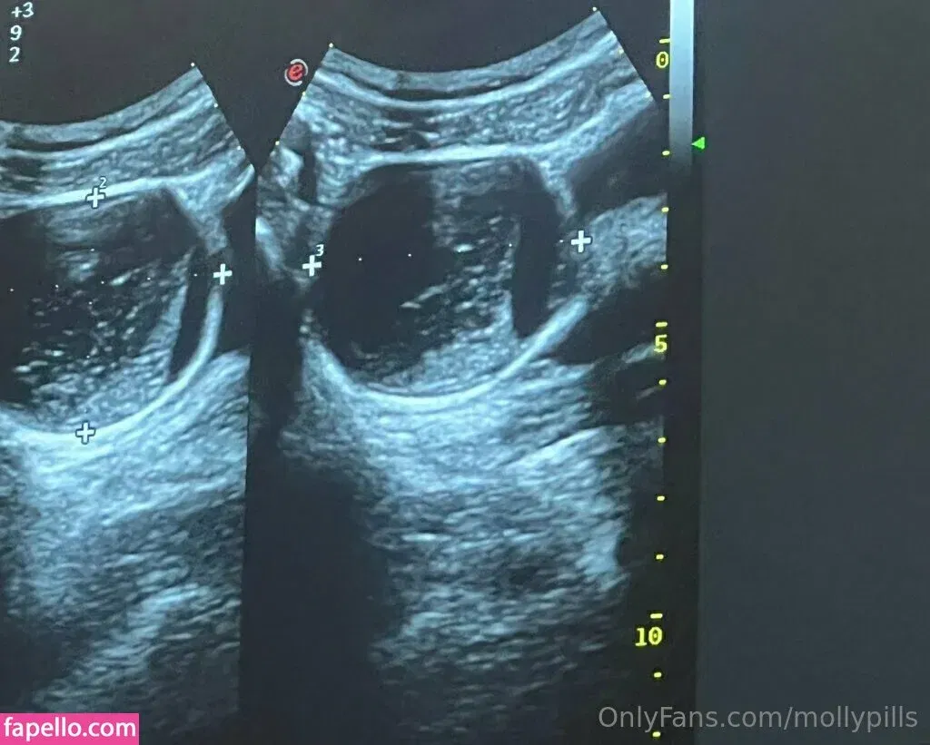 freemollypills Onlyfans Photo Gallery 