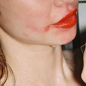 Herbert Twins Onlyfans Photo Gallery 