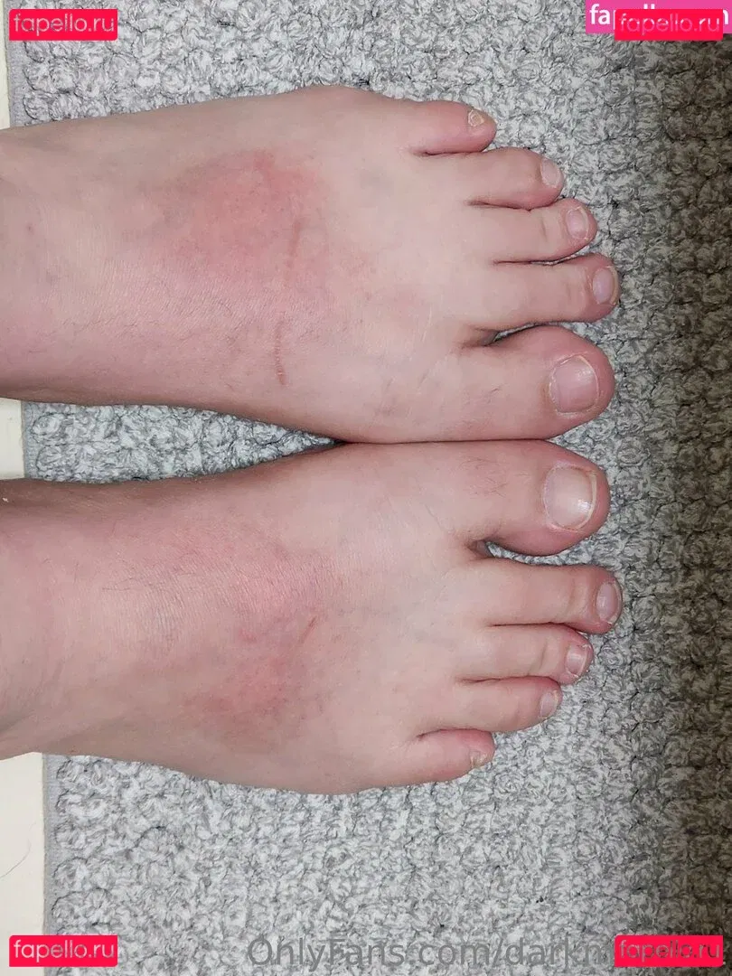 darkmorbid1 Onlyfans Photo Gallery 